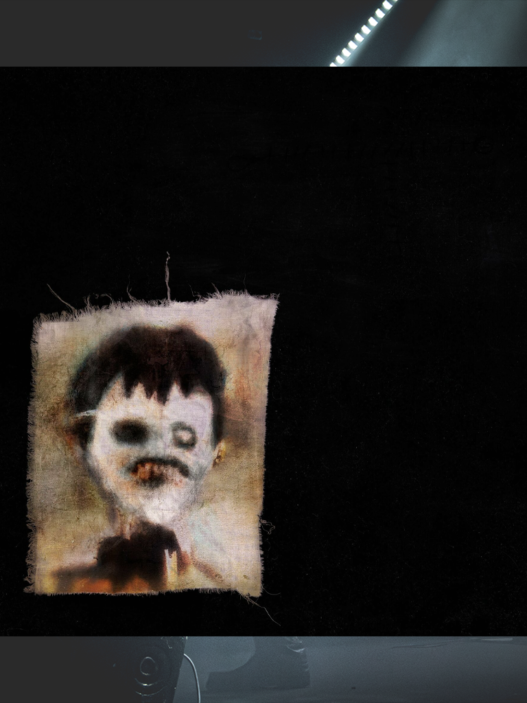 Por cesárea de Dillom